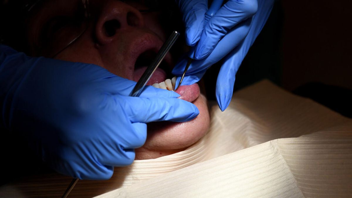 Remboursement des traitements des caries : une avancée pour la santé dentaire en France