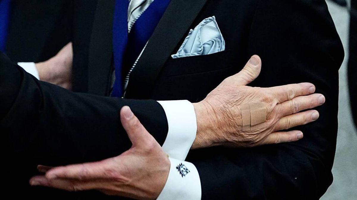 Les mystères de la santé de Donald Trump : un pansement qui suscite des questions