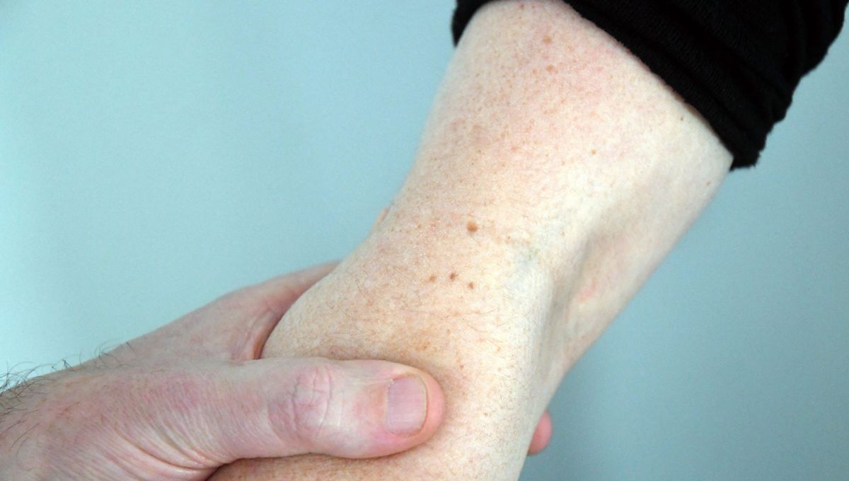 Une nouvelle clinique de dermatologie à Grasse face à la pénurie de spécialistes